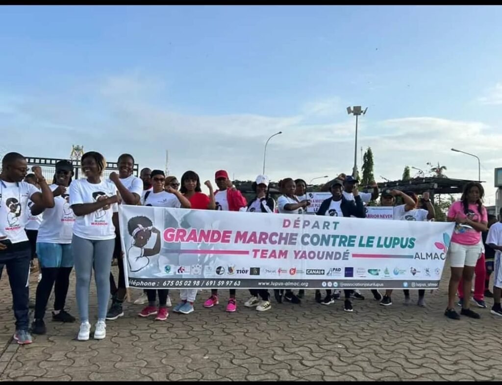 Cameroun-Association J’ai un Lupus Maladie Auto-immune Cameroun (ALMAC)-Société  Camerounaise de rhumatologie : Mobilisation pour une meilleure prise en charge du lupus